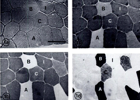 Типы мышечных волокон человека