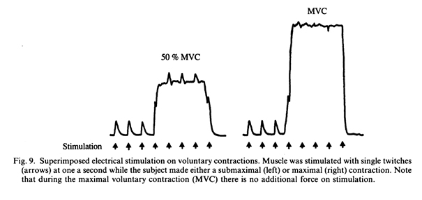Наложение электрической стимуляции при произвольном сокращении мышцы.