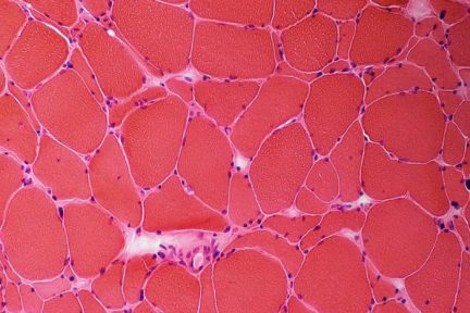 Миниатюра для записи Гипертрофия мышц, гиперплазия и капилляризация мышечных волокон после силовой тренировки