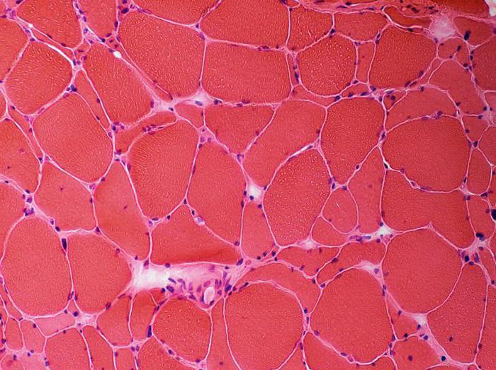 Мышечные волокна