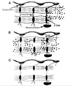 Схематическое повреждение мышечного волокна