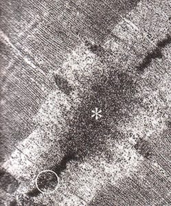 Электронная фотография мышечного волокна человека после выполнения эксцентрических упражнений. Обозначения: * - миофибриллы с разрушенными Z-дисками; миофибрилла с неповрежденным Z диском. По: J.G.Yu, L.Carlsson, L.E. Thomell, 2004.