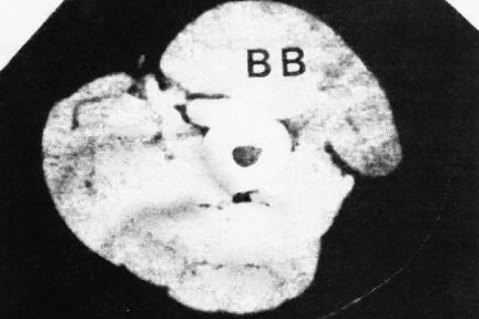 Миниатюра для записи Методы оценки степени гипертрофии скелетных мышц