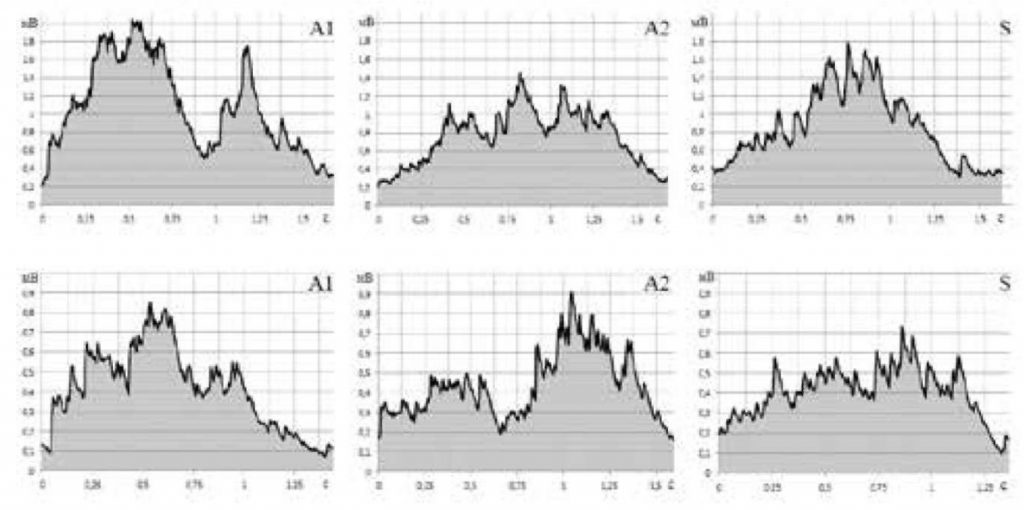 ЭМГ короткой головки двуглавой мышцы плеча при выполнении сгибания и разгибания предплечья (сверху) и медиальной головки трехглавой мышцы плеча при выполнении французского жима