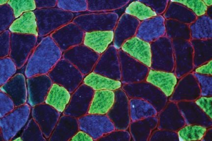 Миниатюра для записи Активность ферментов и состав мышечных волокон в скелетных мышцах