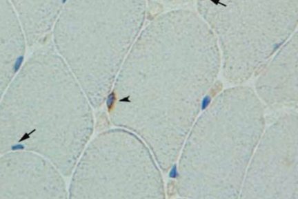 Миниатюра для записи Влияние силовой тренировки и ее прекращения на клетки-сателлиты в мышцах человека