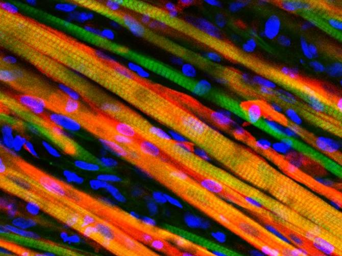 Типы мышечнных волокон