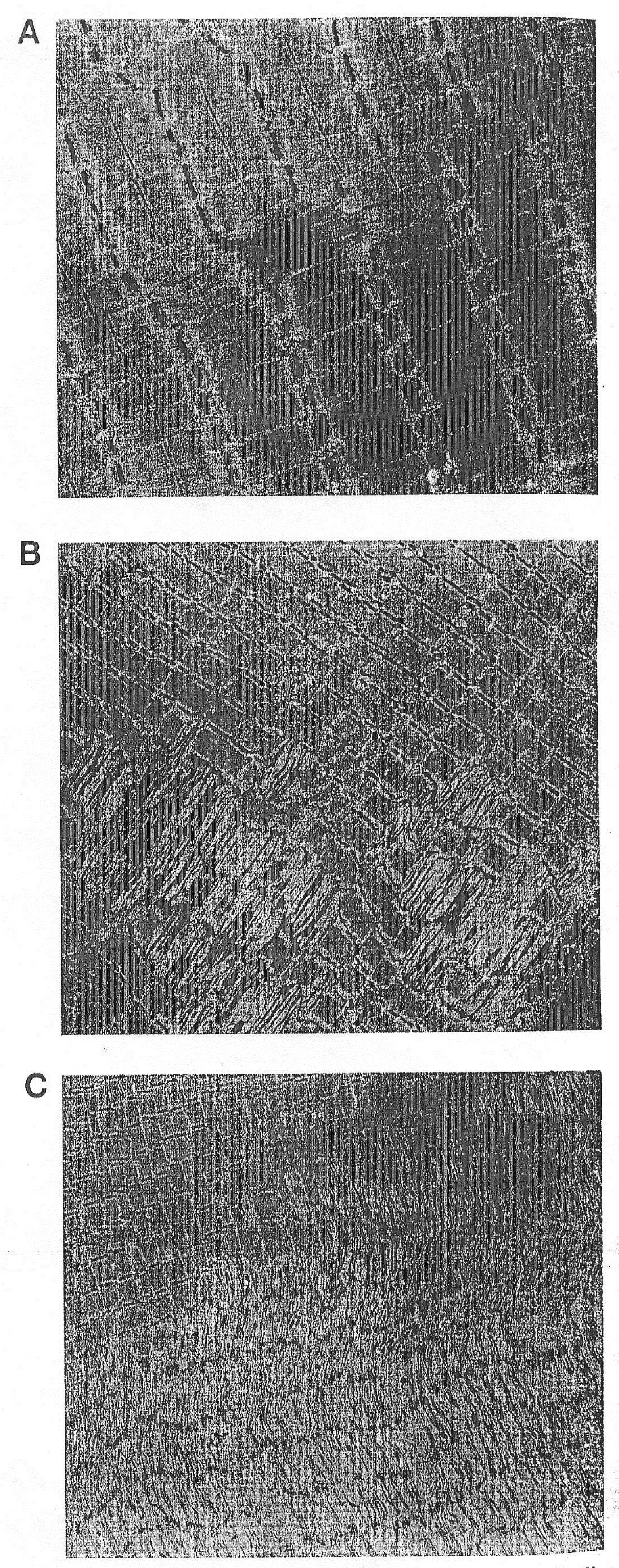 Микрофотографии, характеризующие повреждение миофибрилл