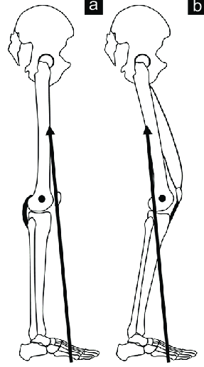 Направление силы реакции опоры при полном (а) и неполном (b) разгибании коленного сустава в фазу опоры при ходьбе (Ganjwala D, Shah H., 2019)