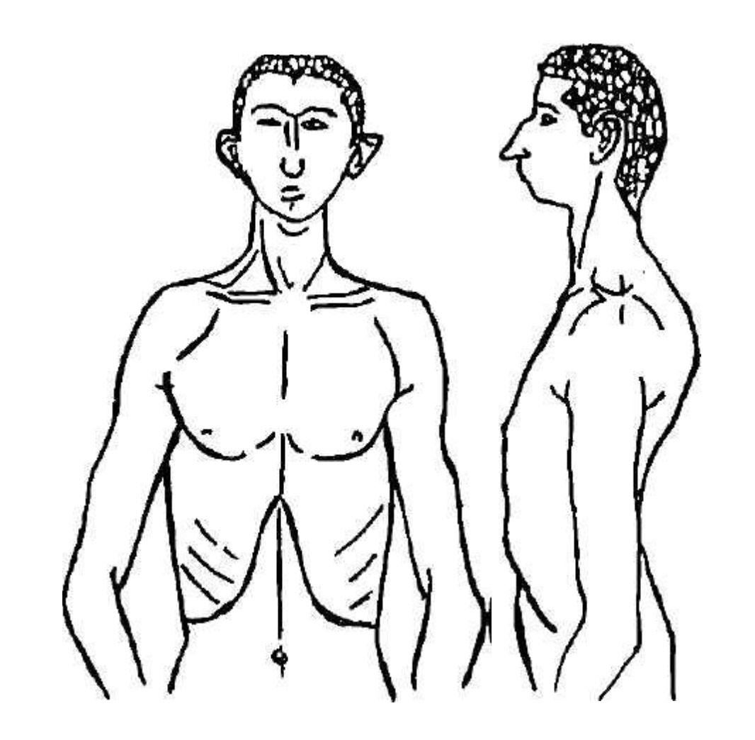 Рис.3. Астенический тип по Э. Кречмеру