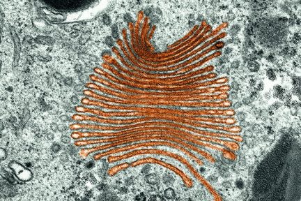 Миниатюра для записи Комплекс (аппарат) Гольджи