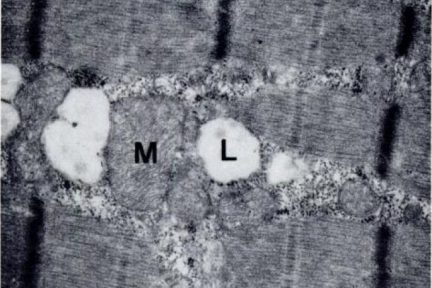 Миниатюра для записи Адаптация различных типов мышечных волокон к нагрузкам