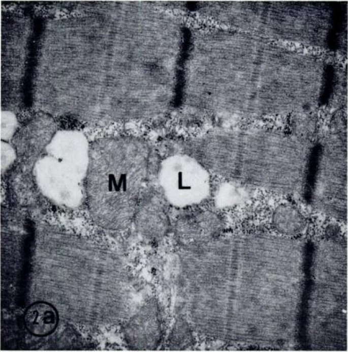 Миофибриллы