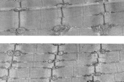 Миниатюра для записи Пролиферация (деление) миофибрилл