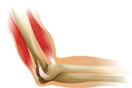 Миниатюра для записи Мышечно-сухожильный комплекс