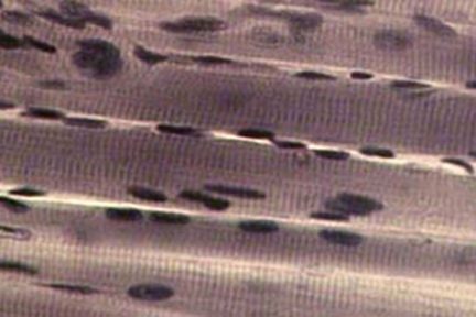 Миниатюра для записи Ядра мышечного волокна (миоядра)