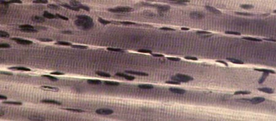 Ядра мышечного волокна (миоядра)