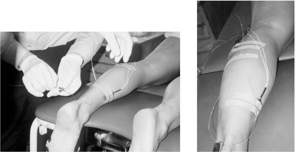 Прямое измерение силы трехглавой мышцы голени