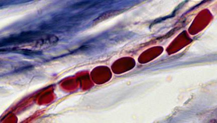 Миниатюра для записи Кровеносные сосуды скелетной мышцы