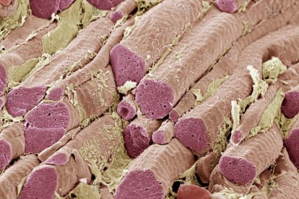 Миниатюра для записи Капилляризация и характеристики мышечных волокон различных типов у тяжелоатлетов и пауэрлифтеров