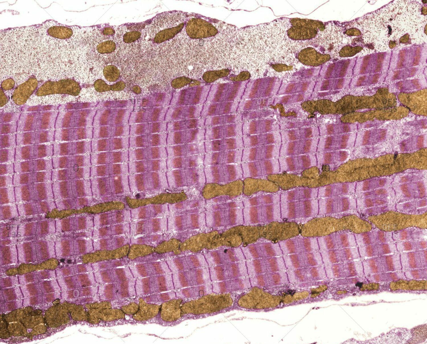 Мышечные волокна