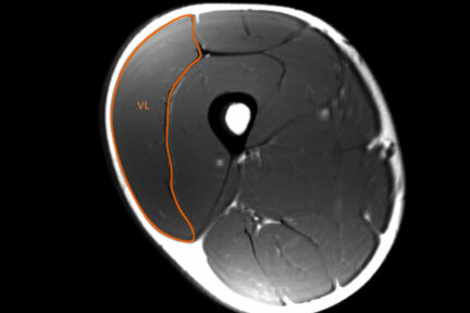 Миниатюра для записи От чего зависит сила мышц? (анатомические факторы)
