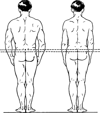 Положение ОЦМ у мужчин разного телосложения (М.Ф.Иваницкий, 1985)