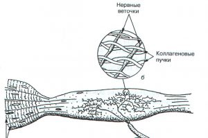 Строение сухожильного органа Гольджи (А.Дж. Мак-Комас, 2001)