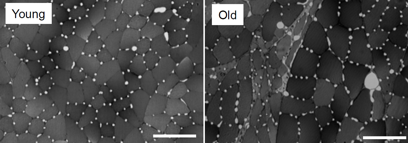 Световая микрофотография поперечного разреза подошвенной мышцы молодой и старой крысы