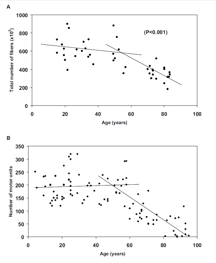 Соотношение между количеством мышечных волокон (А) и количеством ДЕ (В) в широкой латеральной мышце бедра) у мужчин в возрасте от 18 до 82 лет [4]