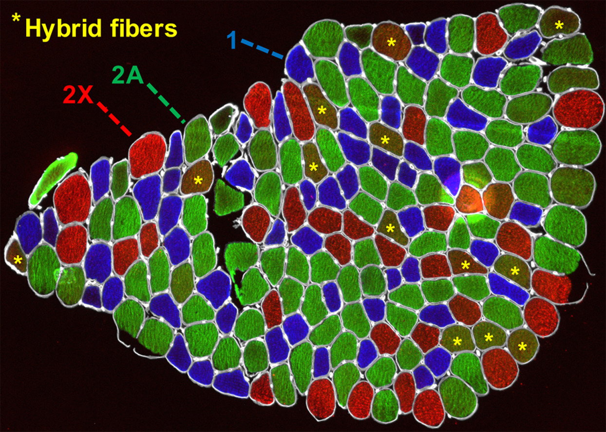 Типы мышечных волокон широкой латеральной мышцы бедра (m. vastus lateralis) молодого мужчины, классифицированные посредство антител [22]