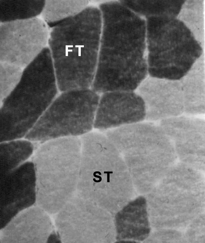 Типы мышечных волокон в четырехглавой мышце (m. quadriceps femoris) человека. Классификация по степени активности фермента миозин АТФ-азы. Преинкубация при pH=10,4 [27]