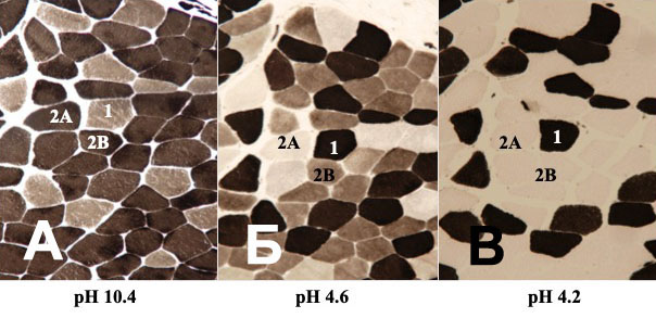 Типы мышечных волокон после проведения процедуры преинкубации в ще-лочной (pH=10,4) и кислой (рН= 4,6 и 4,2) средах