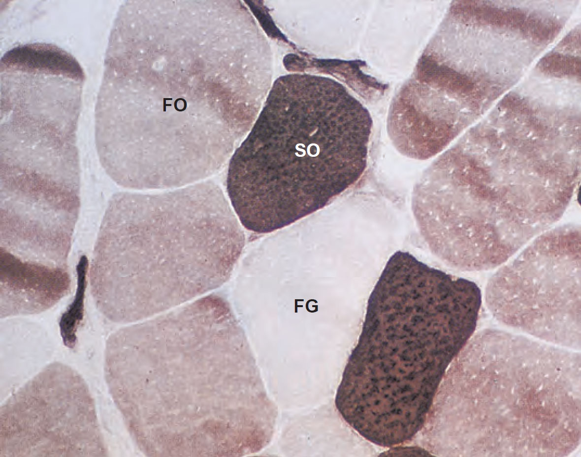 Типы мышечных волокон в пучке волокон скелетной мышцы человека. Классификация по степени активности фермента сукцинатдегидрогеназы (СДГ) [13]