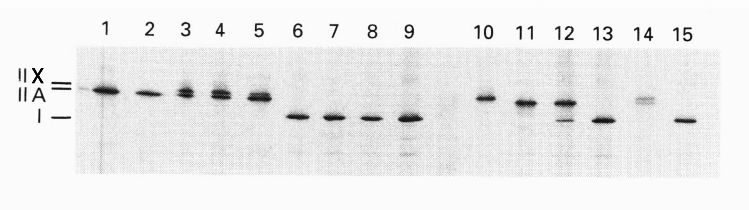 Цифровые фотографии распределения изоформ MHC в фрагментах 15 отдельных мышечных волокон четырехглавой мышцы бедра [11]