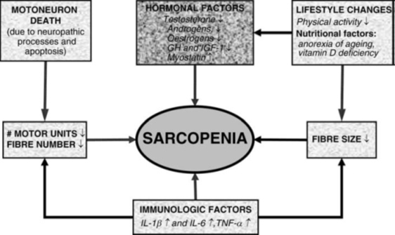 Схема, иллюстрирующая влияние различных факторов на саркопению