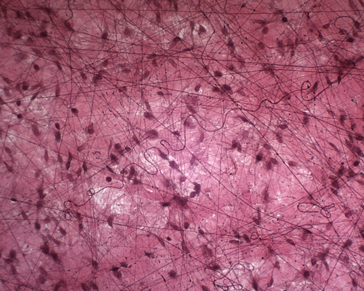 Рыхлая волокнистая соединительная ткань