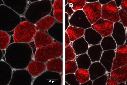 Миниатюра для записи Снижение массы скелетных мышц при старении в основном объясняется уменьшением размера мышечных волокон II типа