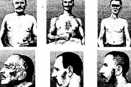 Миниатюра для записи Типы телосложения (конституции) по Э. Кречмеру