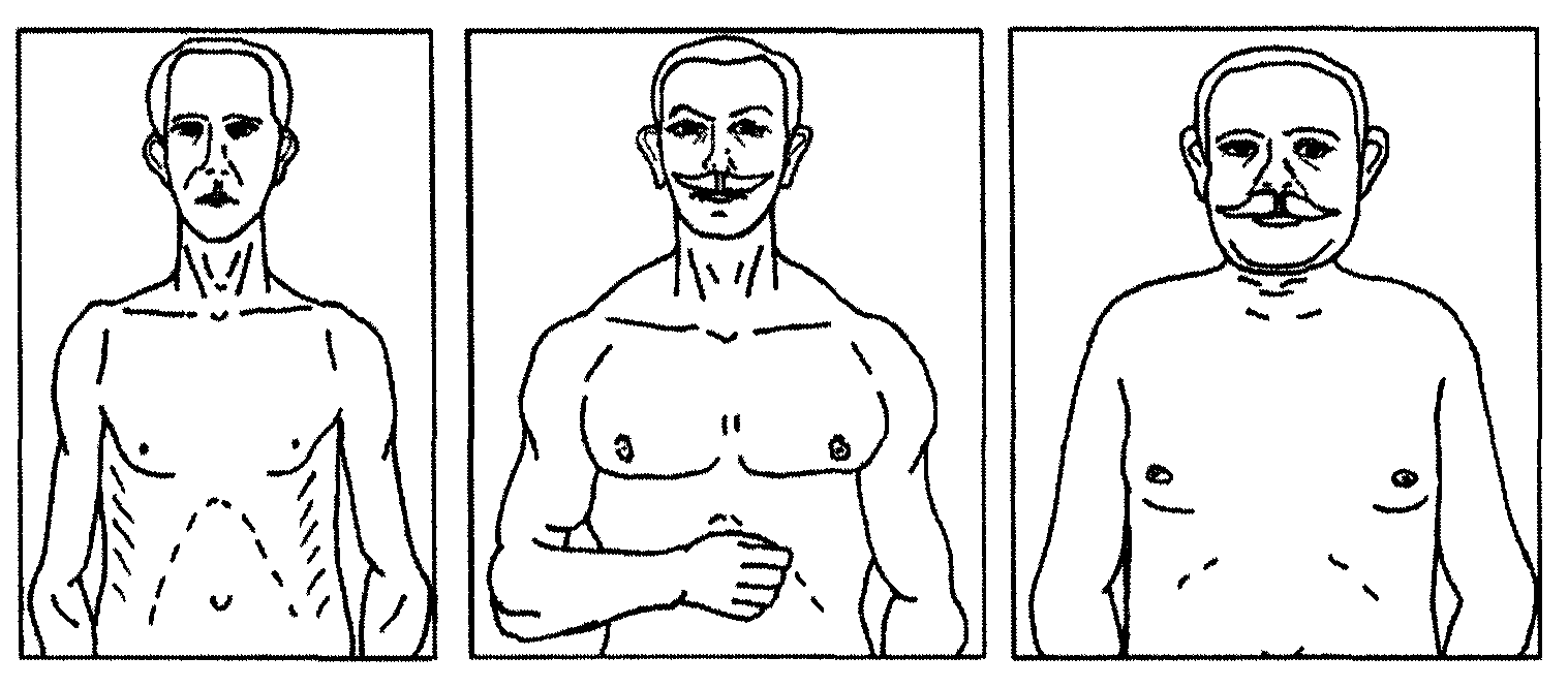 Соматотипы по Э.Кречмеру