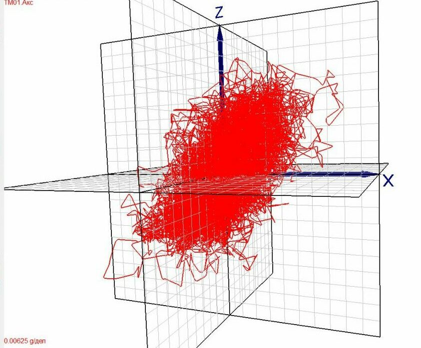 Пространственная кинезиограмма больного атаксией, полученная посредством стабилометрического комплекса Траст-М