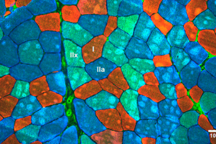 Миниатюра для записи Типы мышечных волокон и методы их классификации
