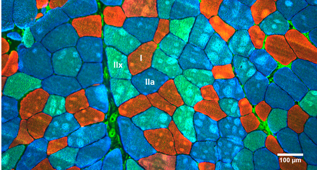 Типы мышечных волокон. Классификация волокон на основе иммуногистохимического анализа Carroll K.M. et all., 2019