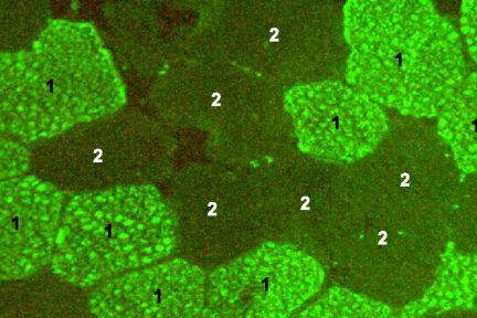 Миниатюра для записи Композиция мышечных волокон 14 мышц плеча