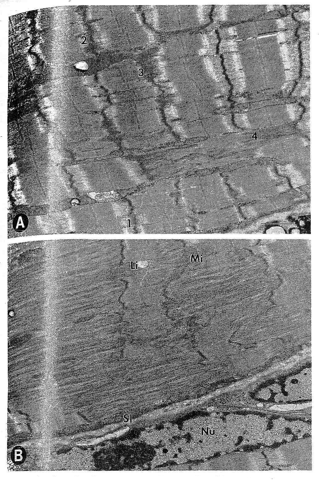 Разрушение мышцы после эксцентрического упражнения